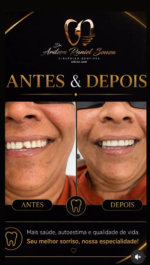 Antes e depois de tratamento odontológico